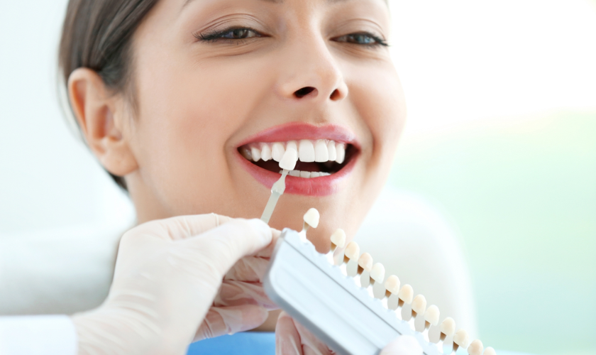 Dental Veneer Trends
