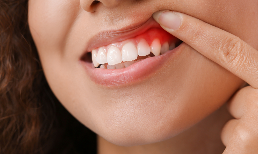Know About Gum Disease