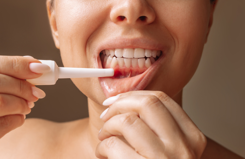 Recognize and Treat Gum Recession