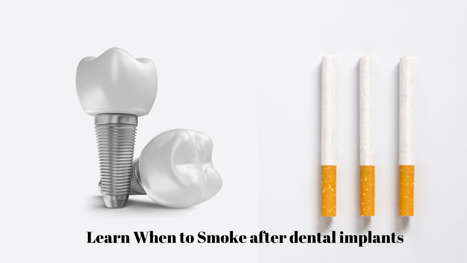 when to smoke after dental implants