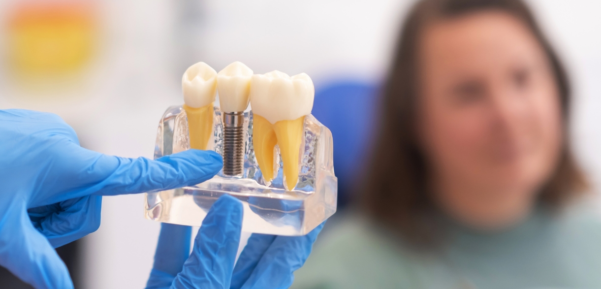 can dental implants improve your oral health