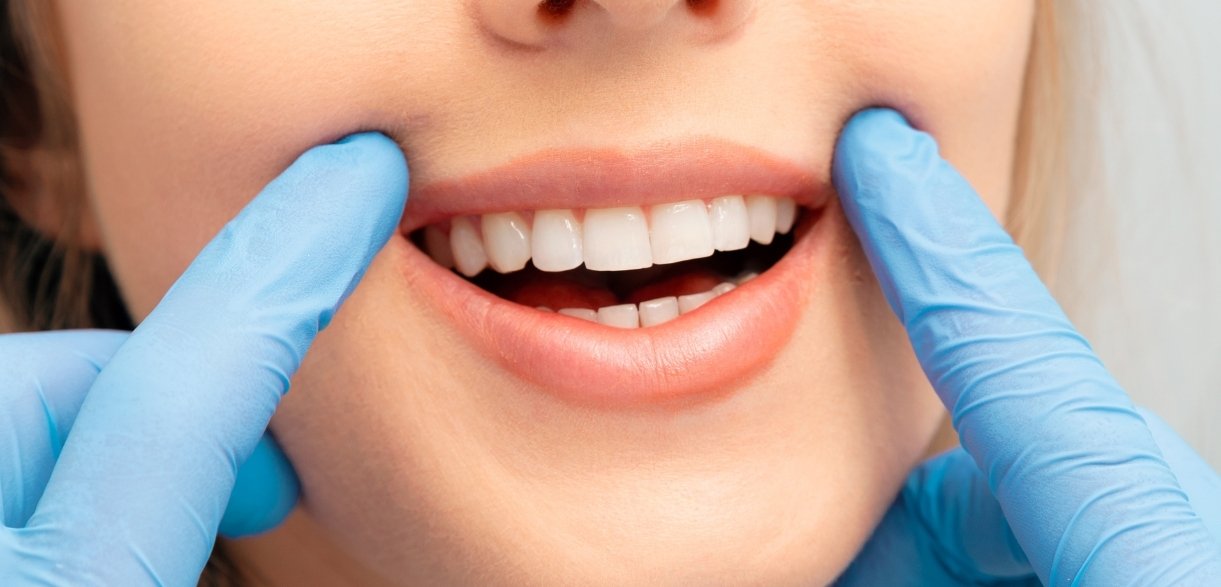 get your smile holiday-ready with 12 days of Christmas smile care tips