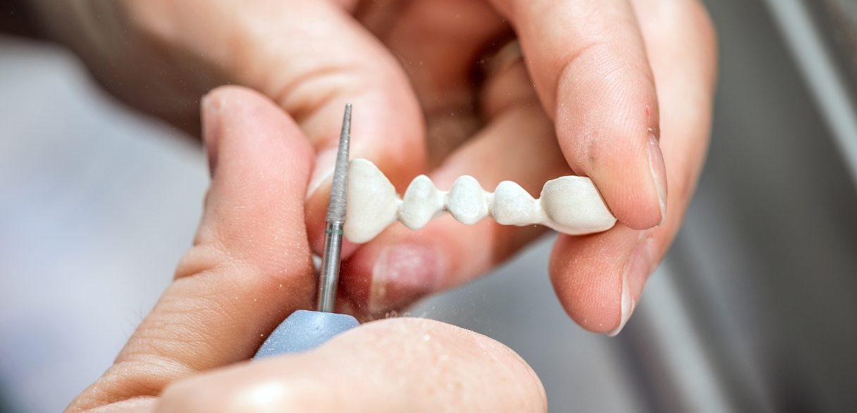 reasons why you should consider a crown over a filling